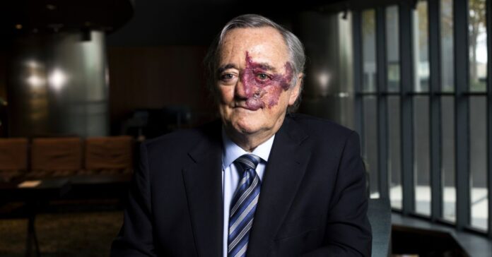 Mariano Barbacid asegura que el nuevo tratamiento dirigido contra el cáncer de páncreas duplica la supervivencia sin quimioterapia