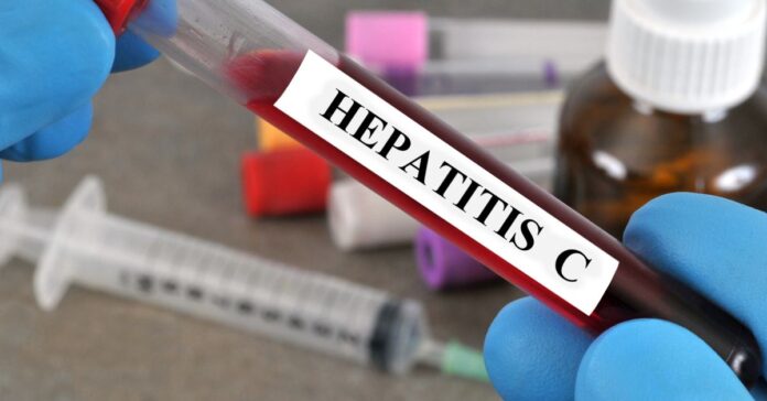 España, más cerca de eliminar la hepatitis C: el reto es encontrar a quienes aún no lo saben